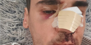 El periodista Fonsi Loaiza tras la agresión
